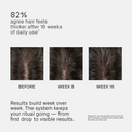 Iconic Scalp System
