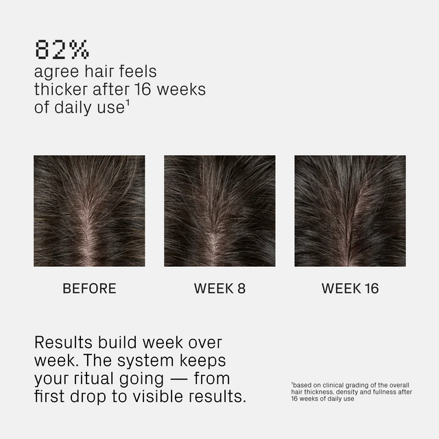 Three top-view photos show hair thickness progression—Before, Week 8, and Week 16—demonstrating visibly fuller hair over time with the Isima Iconic Scalp System. Highlighting its effective scalp care for hair growth, the text notes that 82% of users noticed thicker hair after just 90 days of daily use.